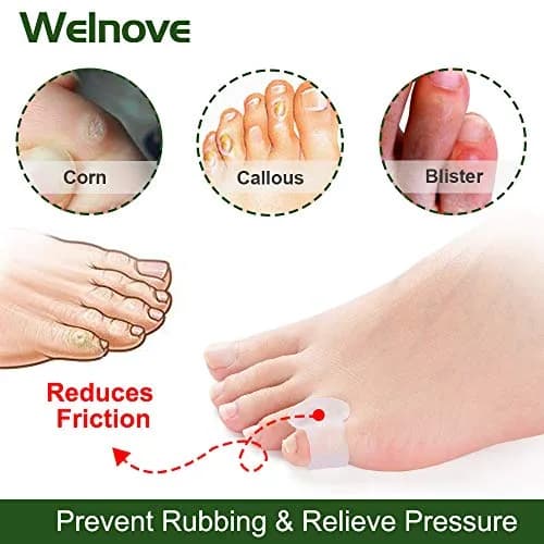 Welnove Gel Toe Separator Small Toe Cushions Pack of 12 | Prevents Rubbing & Reduces Pressure thumbnail 3