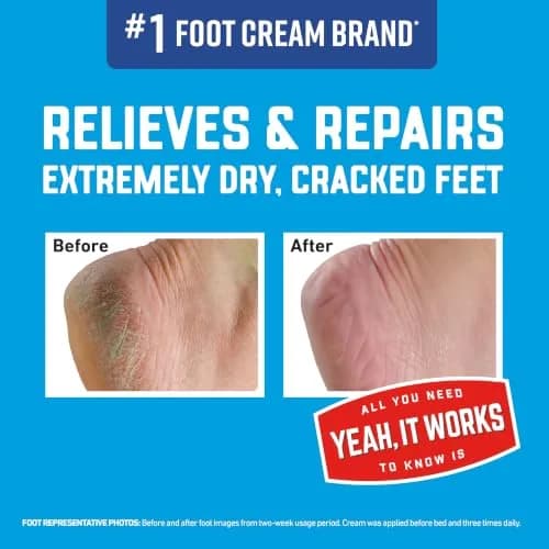 O'Keeffe's Healthy Feet Cream 7 oz (198 g) | Intensive Relief for Cracked Feet thumbnail 2