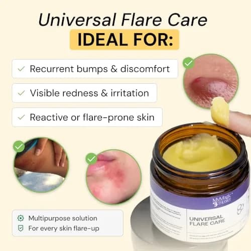 MyMagicHealer Universal Flare Care Drawing Salve 118 ml (4 oz) | For Skin Flare-Ups, Boils, Cysts & Irritated Skin thumbnail 2