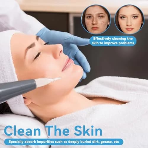 Agatige Vacuum Glass Tube Kit for Blackhead Removal | 3pcs thumbnail 3