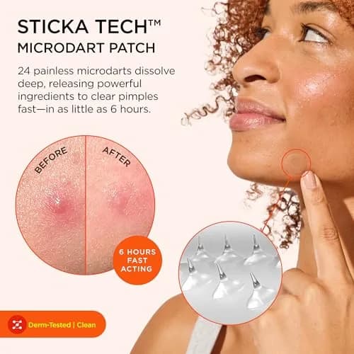 ZitSticka Killa Kit Microdart Pimple Patch for Face, 20 Count | Fast-Acting, Target Emerging Pimples thumbnail 2