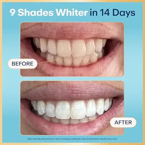Lumineux Teeth Whitening Strips 18 Count (1 Month Supply) | Dentist-Formulated, Peroxide-Free, Enamel-Safe thumbnail 2