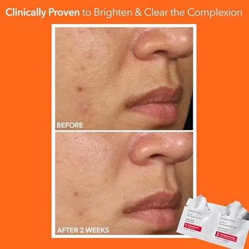 Dr Dennis Gross Alpha Beta Extra Strength Exfoliating Daily Peel 5 Pack | Professional Results for Radiance & Pores thumbnail 4