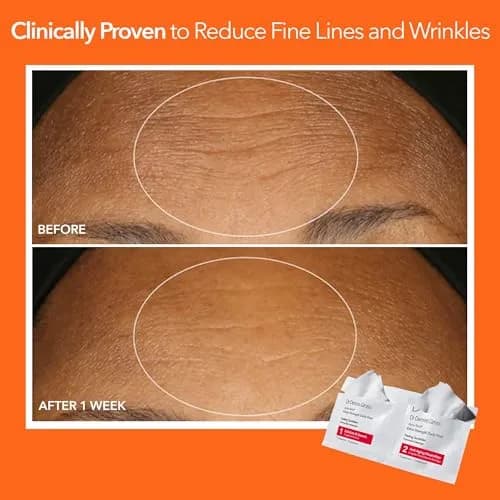 Dr Dennis Gross Alpha Beta Extra Strength Exfoliating Daily Peel 5 Pack | Professional Results for Radiance & Pores thumbnail 6