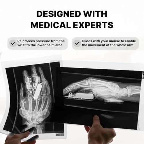 DELTAHUB Carpio 2.0 - Left-Handed Ergonomic Wrist Rest for Mouse, Pain Relief, Anti-Fatigue, Small, Black thumbnail 4