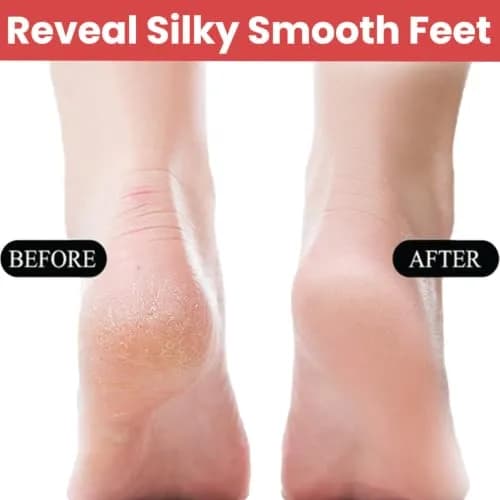 Temperia Professional Metal Foot Scrubber Tool 25.9 cm (10.2 inch) | Removes Dead Skin & Calluses thumbnail 2