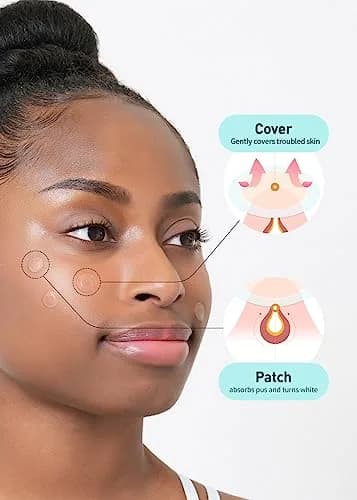 OLIVE YOUNG Hydrocolloid Spot Patch Big 81 Count | Acne & Pimple Treatment for All Skin Types thumbnail 3