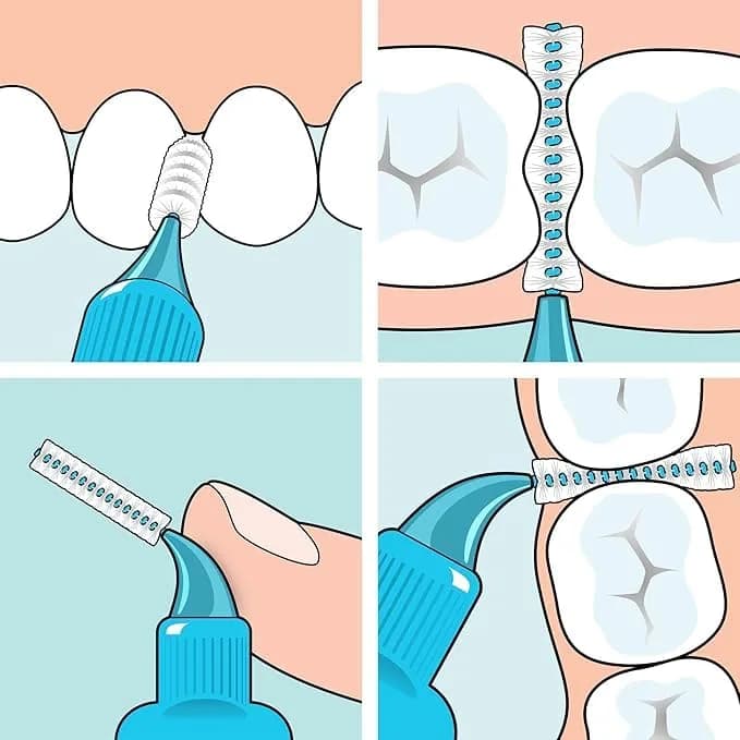 TePe Original Interdental Brushes Size 5-0.8mm | 20 Count (Blue) | Dermatologist Tested Hypoallergenic Toothbrush thumbnail 6