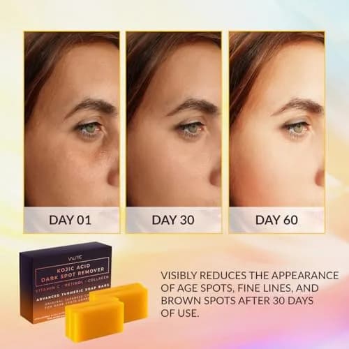 VALITIC Kojic Acid Dark Spot Remover Soap Bar 4 Pack (14 oz / 397 g) | Original Japanese Complex for Even Skin Tone thumbnail 2