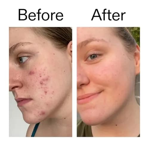 The INKEY List Vitamin C & EGF Serum 30ml | Brightens & Rejuvenates Skin thumbnail 8
