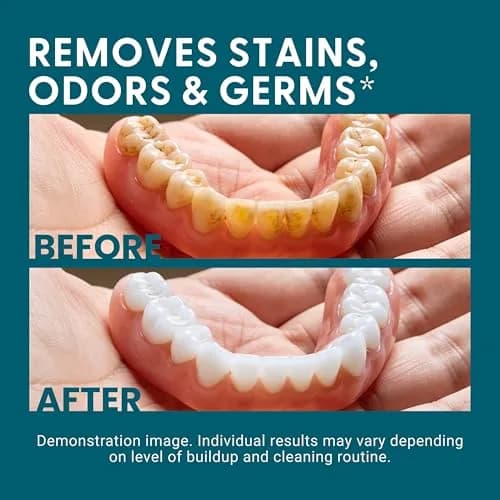 M3 Naturals Denture Bath Case with No-Spill Strainer for Retainers, Mouthguards, Night Guards, 1 Count Blue | Phthalate-Free thumbnail 8