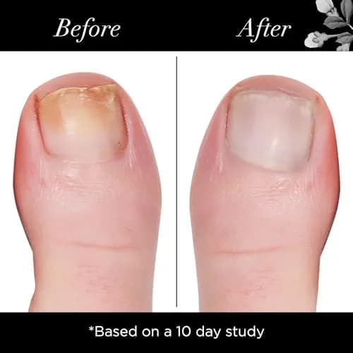 butter LONDON Nail Brightening Concealer 0.4 Fl Oz | Toxin-Free Nail Care & Brightening thumbnail 4