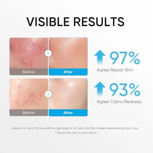 SKINTIFIC 5X Ceramide Barrier Repair Moisturizer for Sensitive Skin | Hydrates & Strengthens Skin Barrier thumbnail 3
