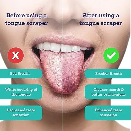 GuruNanda Tongue Scraper for Adults (2 Pack) with Travel Case | Stainless Steel Oral Care Tool thumbnail 2