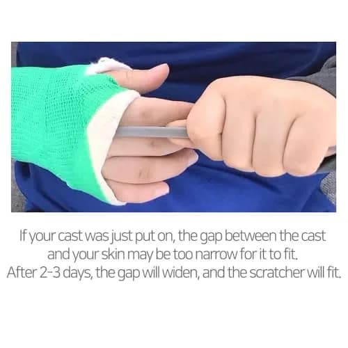 SC SCRATCH 'N' CLEAN Cast Scratcher & Cleaner 17 Inch (Pack of 2) | Relieves Itch & Cleans Casts Safely thumbnail 6