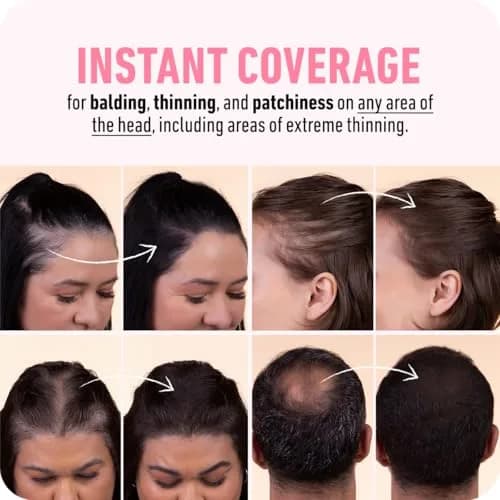 Boldify Hairline Powder Black 10g (0.35 oz) | Instant Root Coverage & Thinning Hair Filler thumbnail 5