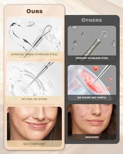 SG Nekoo Professional Milia & Blackhead Removal Tool Kit with Titanium Alloy Needle & Tweezers | Titanium Gold thumbnail 6