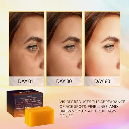 VALITIC Kojic Acid Dark Spot Remover Soap Bars with Vitamin C, Retinol, Collagen, Turmeric - 2 Pack (7 oz / 200g) | Original Japanese Complex for Brighter Skin thumbnail 2