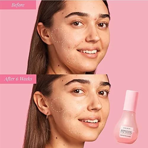 Glow Recipe Watermelon Niacinamide Dew Drops Serum 15ml (0.5 Fl Oz) | Instant Dewy Glow thumbnail 6