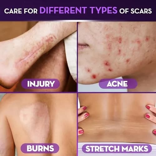 Cicatricure Advanced Scar Gel 28g (1 oz) 3-Pack | Clinically Proven Scar Reduction thumbnail 4