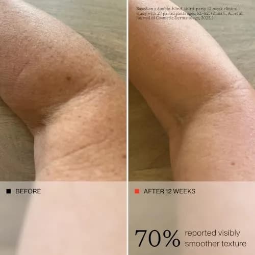 oneskin OS-01 BODY Peptide Moisturizer, 8.45 Fl Oz | Supports Skin Longevity & Hydration thumbnail 4