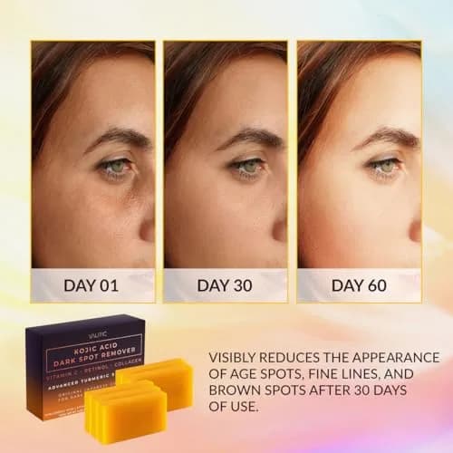 VALITIC Kojic Acid Dark Spot Remover Soap Bars 156g (5.5 oz) | Japanese Complex for Even Tone thumbnail 2