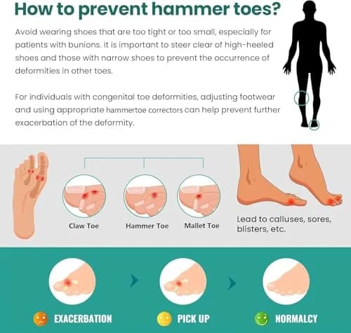 Welnove Hammertoe Corrector 6 Pack Toe Splints - Soft Gel Toe Straighteners for Bent, Curled, Crooked, Claw, Hammer Toes - 3 Different Sizes (Green) thumbnail 4