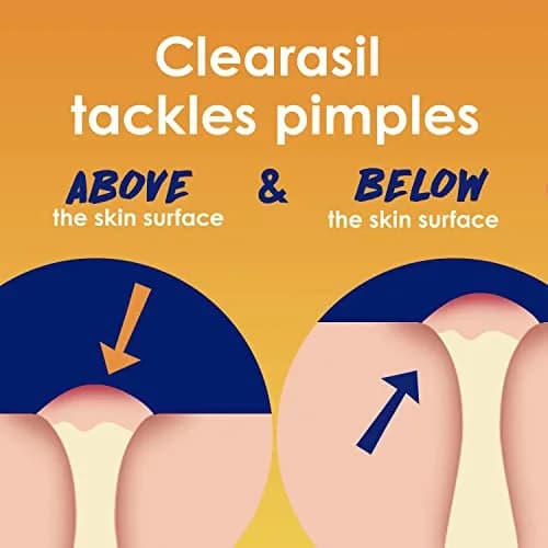 Clearasil Stubborn Acne Control 5in1 Daily Facial Cleansing Pads with Salicylic Acid 180 Count (Pack of 2) | Fights Pimple Size, Oil, and Marks thumbnail 3