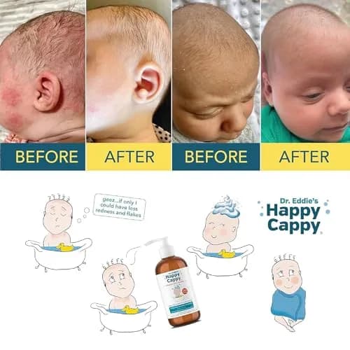 Happy Cappy Medicated Shampoo and Body Wash with Beanie Brush - 237ml (8 Fl Oz) | Pediatrician-Designed for Cradle Cap & Dandruff thumbnail 6