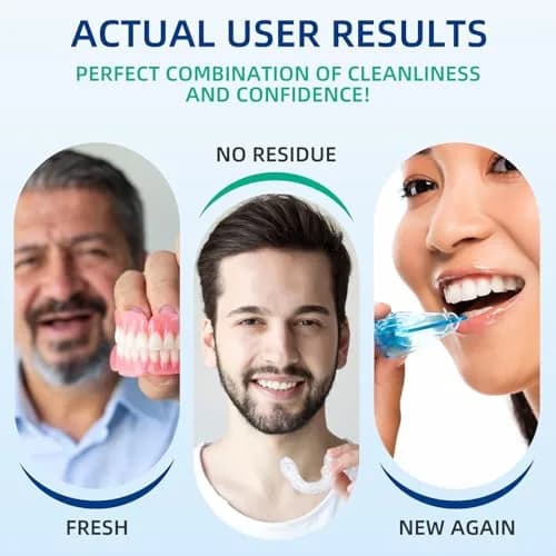 YKL Retainer & Denture Cleaner Kit with 120 Tablets & Guard Bath Cup | 10.38cm L x 9.09cm W x 23.79cm H thumbnail 2