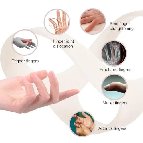 UAKIKAU Oval Finger Splint 8 pcs, Medium (1.5-2.7 Inches) | Supports Mallet, Trigger, Arthritis Fingers thumbnail 8