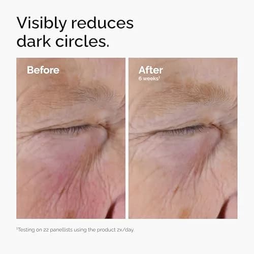 The Ordinary Caffeine Solution 5% + EGCG Eye Serum 60ml (2 Fl Oz) | Reduces Puffiness & Dark Circles thumbnail 4