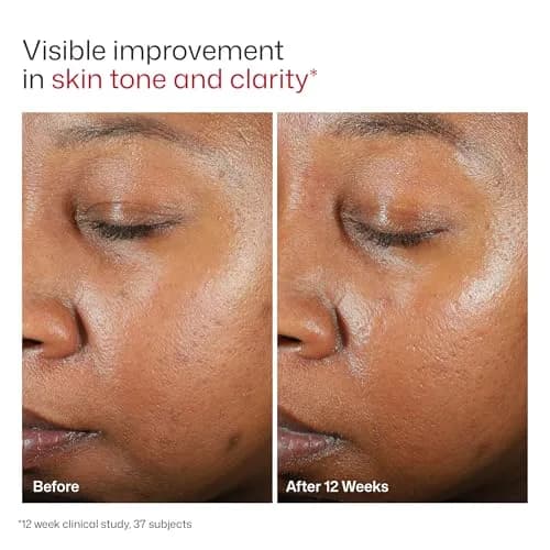 EltaMD UV Clear Deep Tinted Face Sunscreen with Zinc Oxide SPF 46, 50 ml (1.7 Fl Oz) | Calms Acne-Prone & Rosacea-Prone Skin thumbnail 9