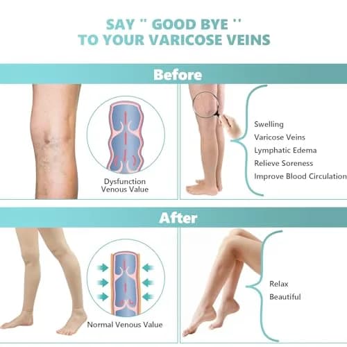 Laubawck Compression Pantyhose for Women 20-30 mmHg | Support & Leg Shaping thumbnail 4