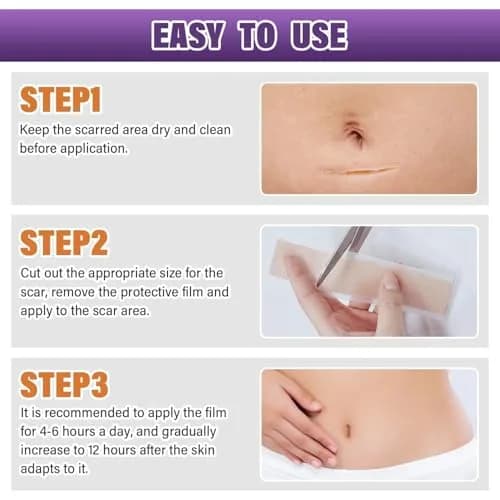 PSECICI Silicone Scar Sheets 3M (1.6" x 120") | Medical Grade Scar Tape for All Scar Types thumbnail 8