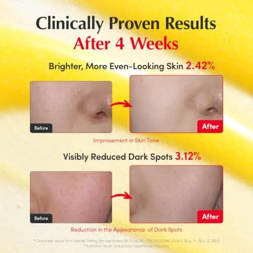 EQQUALBERRY Vitamin Illuminating Serum 30ml (1.01 fl oz) | Niacinamide 4% & TXA for Face Glow thumbnail 4