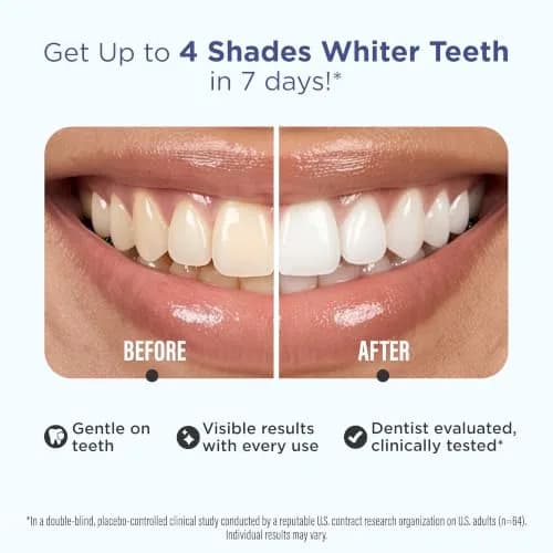 GuruNanda Teeth Whitening Strips Kit 32 Count (Pack of 1) | Hydrogen Peroxide & Coconut Oil for Brighter Smile thumbnail 2