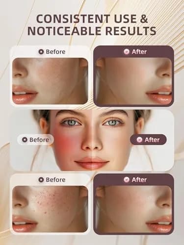 INTEO Microcurrent Facial Machine 2328 | Skin Glow & Anti-Aging thumbnail 3