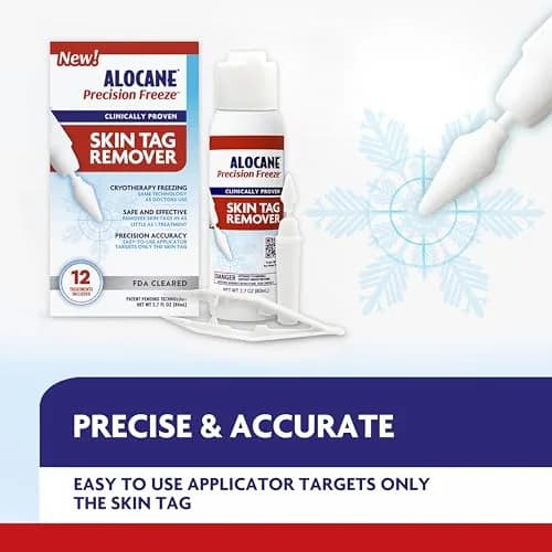 Alocane Skin Tag Removal Kit with 12 Precision Applicators | FDA-Cleared Cryotherapy for Safe Home Use thumbnail 4