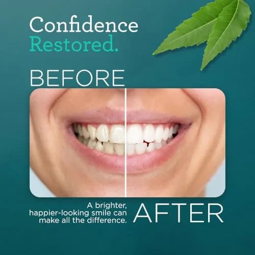 GuruNanda Hydroxyapatite Toothpaste with Neem & Vitamins, 4x4.2oz (16.8oz Total) | Fluoride-Free, Dentist-Recommended thumbnail 8