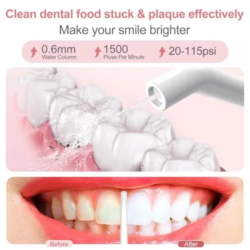 Nicefeel Water Flosser Portable Cordless 300ML | Deep Gum & Braces Care thumbnail 5