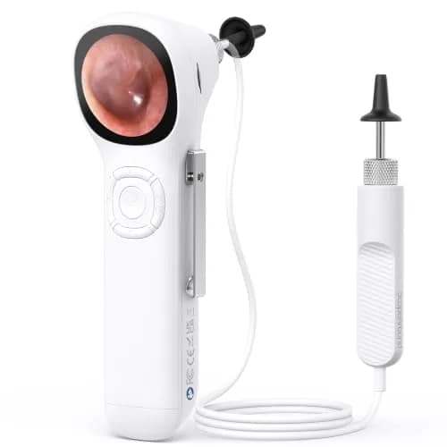 ScopeAround Otoscope with Light | HD Screen, No App Needed, Family Ear Camera thumbnail 1