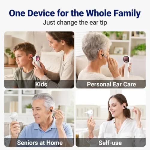 ScopeAround Otoscope with Light | HD Screen, No App Needed, Family Ear Camera thumbnail 4