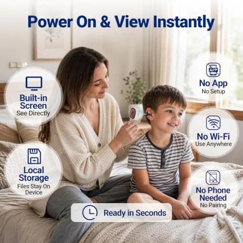 ScopeAround Otoscope with Light | HD Screen, No App Needed, Family Ear Camera thumbnail 2