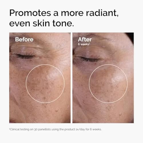 The Ordinary Glycolic Acid 7% Exfoliating Toner 480ml (16.2 Fl Oz) | Brightens & Smooths Skin Tone thumbnail 2
