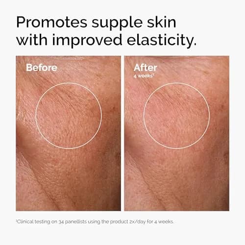 The Ordinary Hyaluronic Acid 2% + B5 Serum with Ceramides, 60ml (2 Fl Oz) | Multi-Depth Hydration for Smoother Skin thumbnail 2