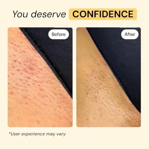MyMagicHealer Thyme & Tea Tree Flare Care Salve 29.57 ml (1 oz) | Soothes Breakout-Prone Skin, Ingrown Hair & Bumps thumbnail 5