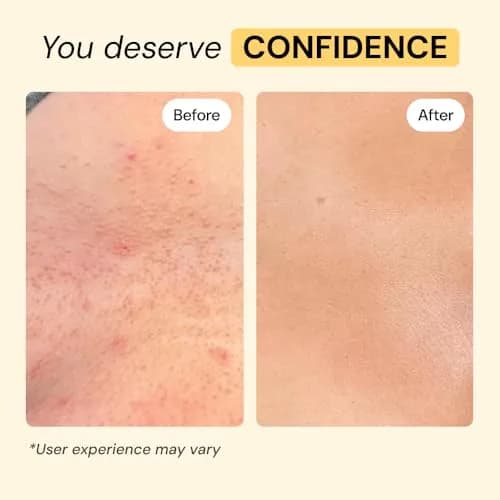 MyMagicHealer Universal Flare Care Drawing Salve 59 ml (2 oz) | Calms Skin Flare-Ups & Irritated Skin thumbnail 5