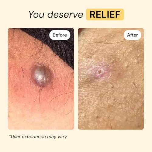 MyMagicHealer Universal Flare Care Drawing Salve 59 ml (2 oz) | Calms Skin Flare-Ups & Irritated Skin thumbnail 3