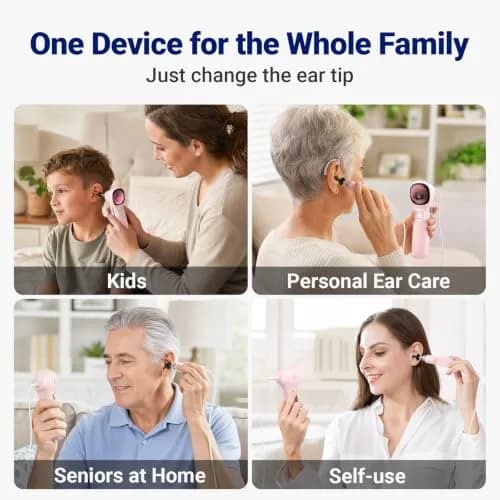 ScopeAround Otoscope with Light No App Needed HD Screen Family Use thumbnail 4